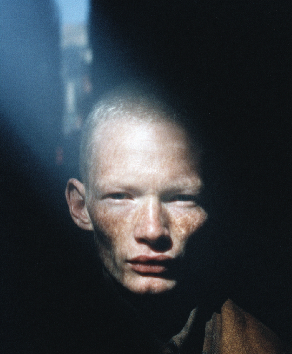 Portrait of an albino man split by dramatic light and shadow